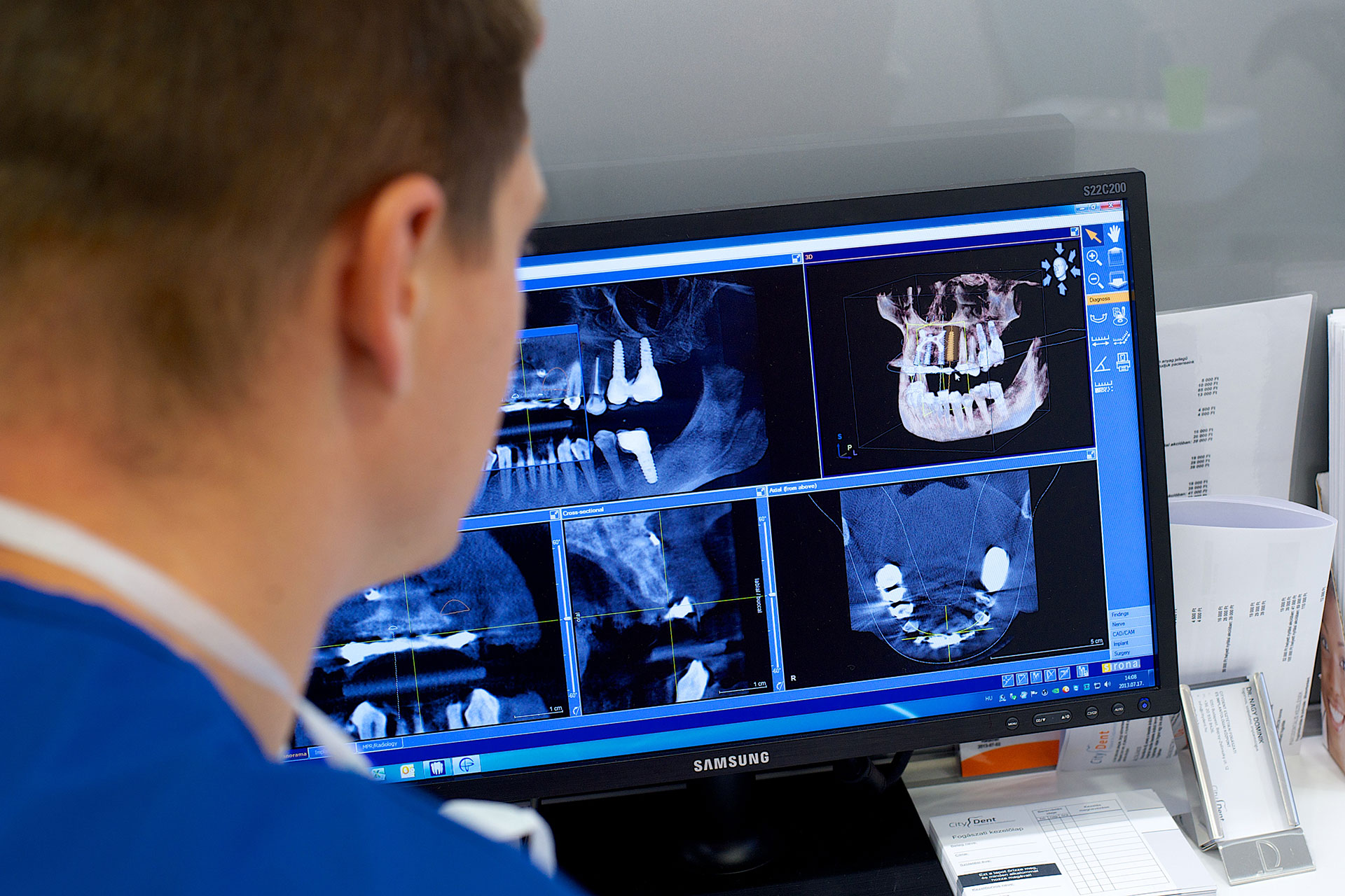 CBCT Budapest, Fogászati góckutatás, digitális diagnosztika